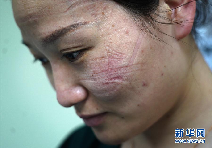 （聚焦疫情防控）（7）&ldquo;最美印痕&rdquo;