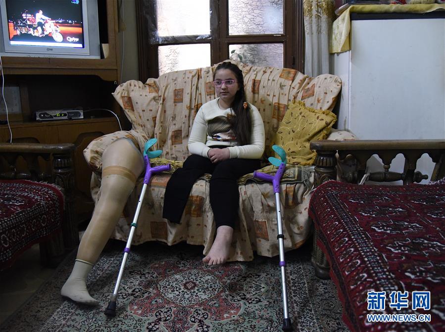 （國際&middot;圖文互動）（1）通訊：戰(zhàn)爭給他們留下殘缺的童年&mdash;&mdash;敘利亞危機9周年記